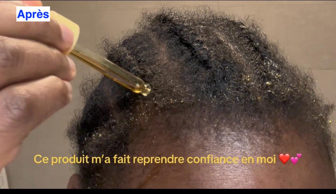 Pousse Intense